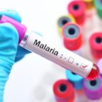 Abia PHCDA Boss Hails Discovery Of Malaria Vaccine