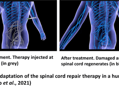 Spinal cord adaptation illustration