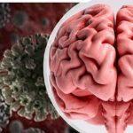 brain damage
