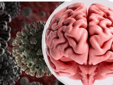 brain damage
