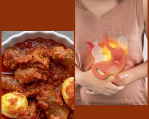 Peptic Ulcer