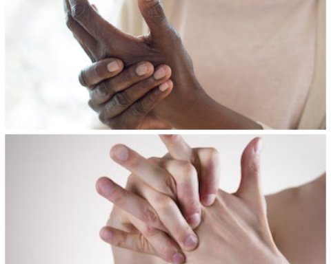 cracking knuckles