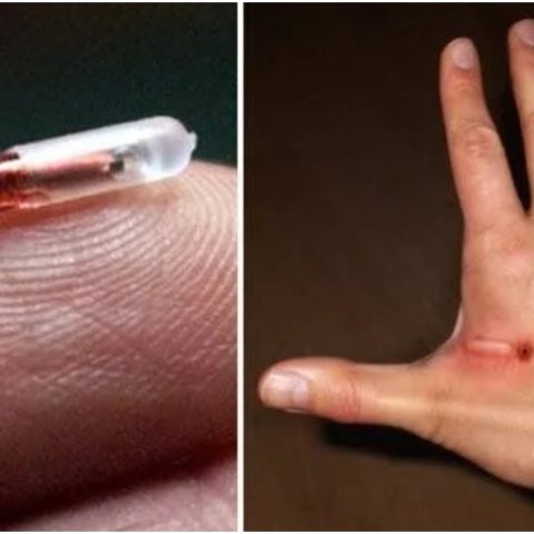 Nokia CEO Says Humans To Be Implanted With 6G Chips, Sets Timeframe