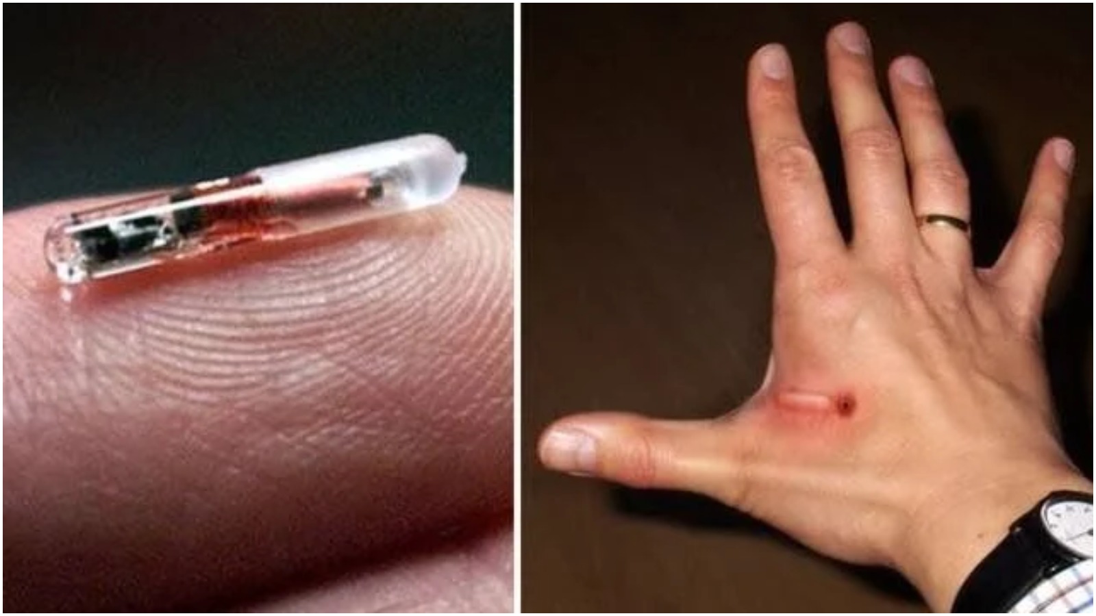 Nokia CEO Says Humans To Be Implanted With 6G Chips, Sets Timeframe