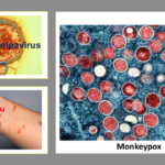 Monkeypox Promoted To Superstardom