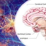Emerging Drugs For Treatment Of Alzheimer’s Disease