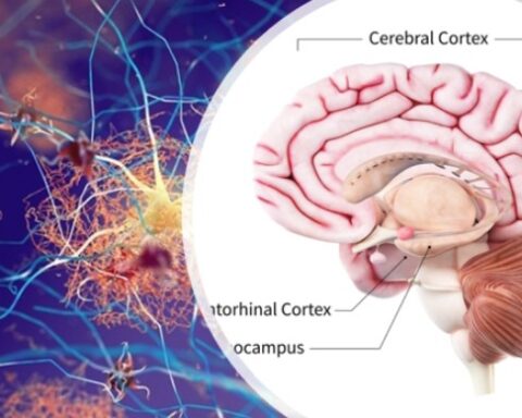 Emerging Drugs For Treatment Of Alzheimer’s Disease