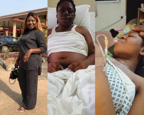 Young Nigerian Lady, Josephine Okoli, Cries Out For Help Over Severe Lupus Infection