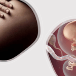 Solution To Fertility Issues In Older Women Is At Hand