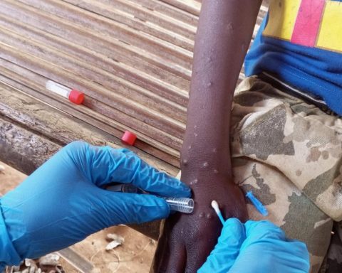 IOM Appeals for USD