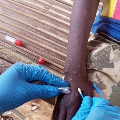 IOM Appeals for USD