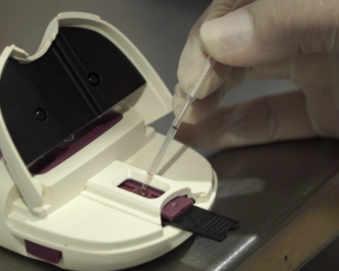 WHO prequalifies diagnostic test to support safer administration of P