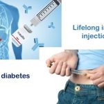 Type 1 Diabetes: Zimislecel Stem Cell Therapy To The Rescue